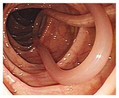insan vücudundaki parazitler