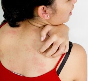 vücuttaki granülomlar - parazit varlığının belirtileri