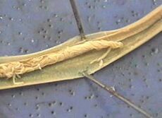 parazit